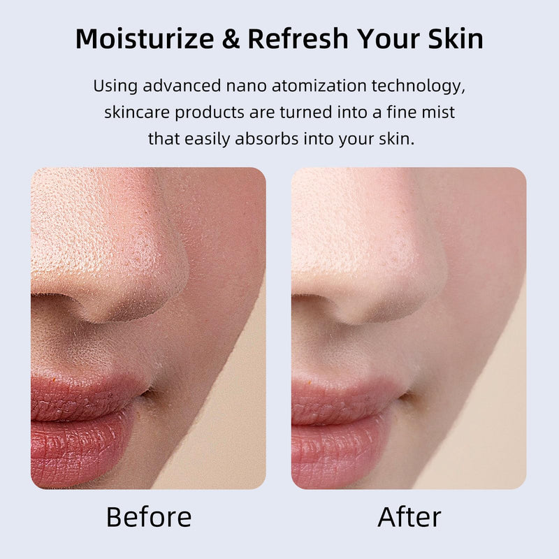 [Australia] - Microtree Nano Facial Steamer - Rechargeable & Portable High Pressure Face Oxygen Sprayer Machine, 0.3mm Nozzle Micro Mist Skin Hydrator, Essential Water Infusion Facial Spa Treatment, White 