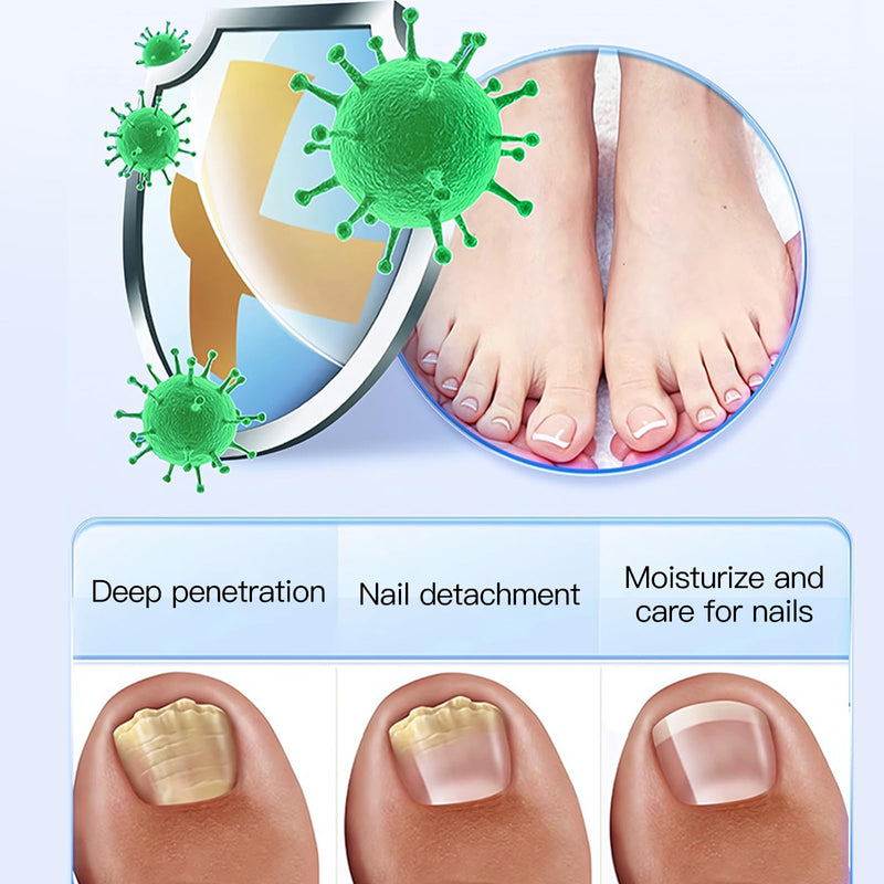 VENROCK Nail Care Pen with Undecylenic Acid 4.125% – Toenail & Fingernail Care Solution, Easy Brush-On Formula for Healthy-Looking Nails, Daily Nail Maintenance with Lactobionic Acid, 0.17 Fl Oz