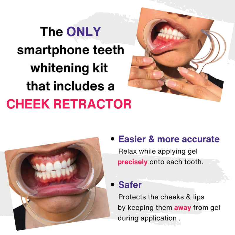 [Australia] - Professional Teeth Whitening Kit, LED Accelerator Light, 36% Carbamide Peroxide Teeth Whitening Gel, 20 Whitening Treatments, Remineralizing Gel, USA-Made Gels 