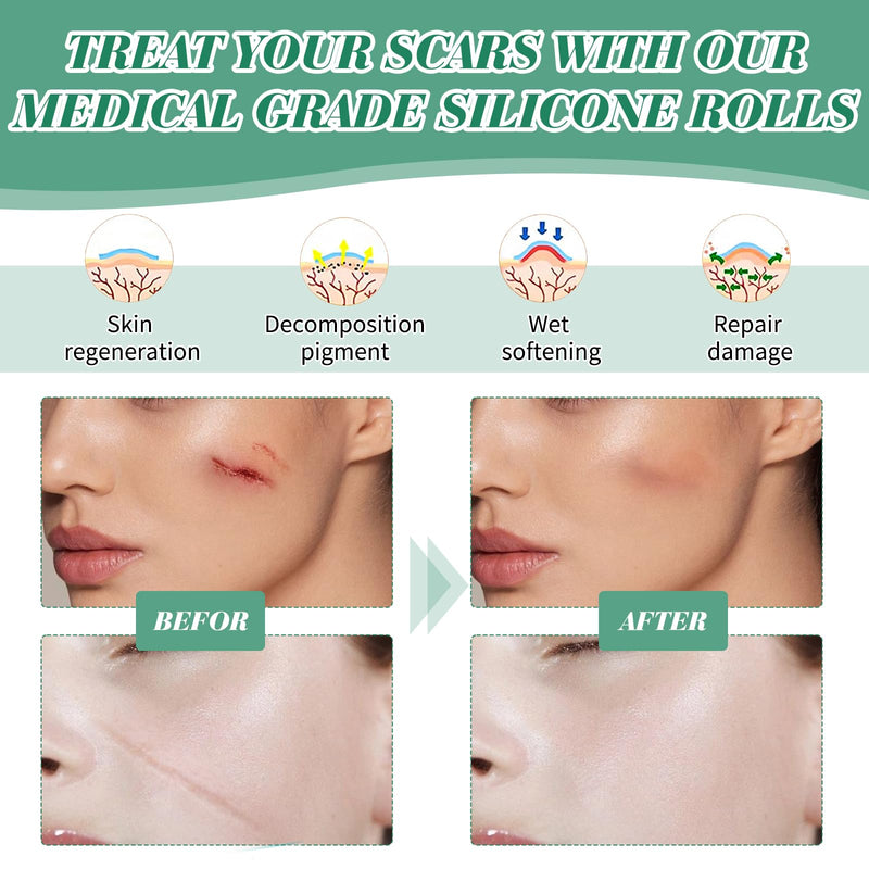 [Australia] - Silicone Scar Tape, silicone plaster for scars, silicone scar plaster, silicone scar plaster, silicone scar sheets, scar tape, silicone scar plaster, for all skin types (4 cm x 1.5 m). 