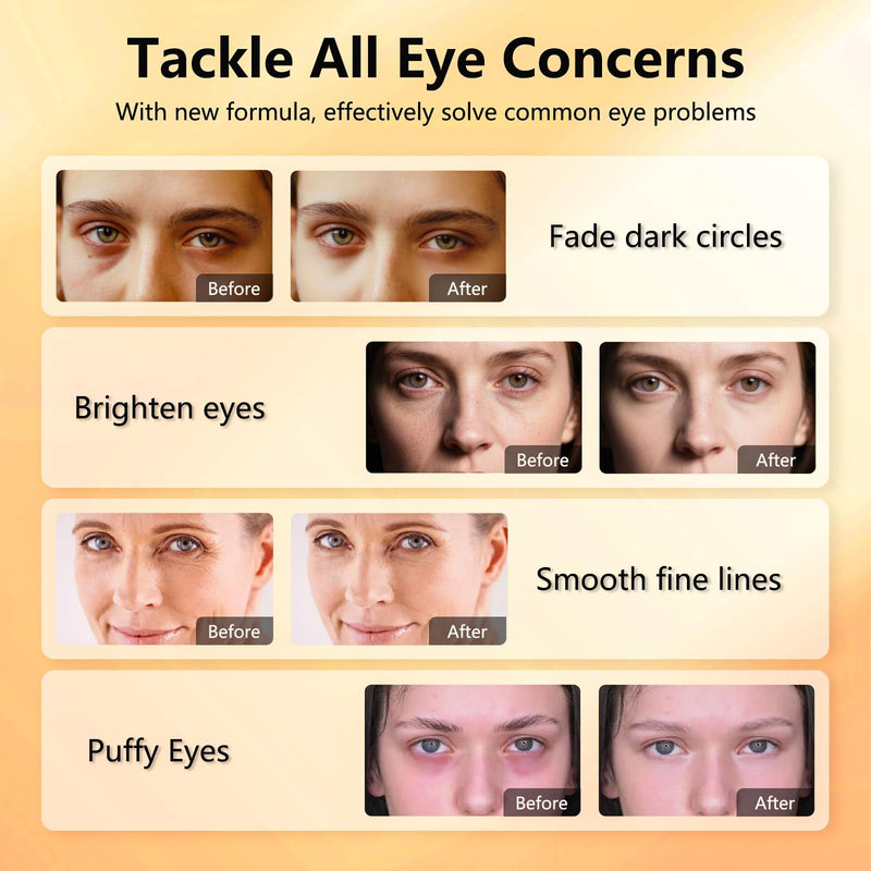 Vitamin C & Caffeine Under Eye Patches for Men & Women 60 Pairs | Eye Masks for Dark Circles, Fine Lines and Puffiness, with Niacinamide Hydra-Gel Collagen, Skincare for Face - 2 PACK 120 Count (Pack of 2)
