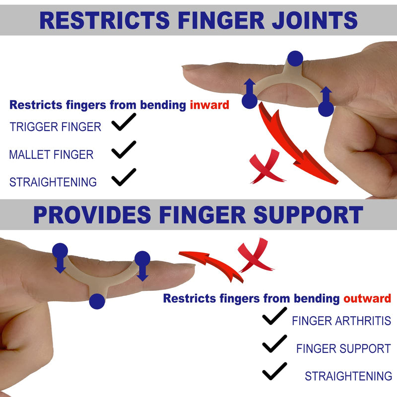 [Australia] - 10Pcs Oval Finger Splints & Sleeves Kit, 6 Graduated Trigger Finger Splint & 4 Finger Sleeves for Trigger/Mallet/Arthritis/Straightening, Finger Brace Support for Thumb/Middle/Ring/Index/Pinky(Size 4,5,6,7,8,9) Size 4,5,6,7,8,9 (with Sleeves) 