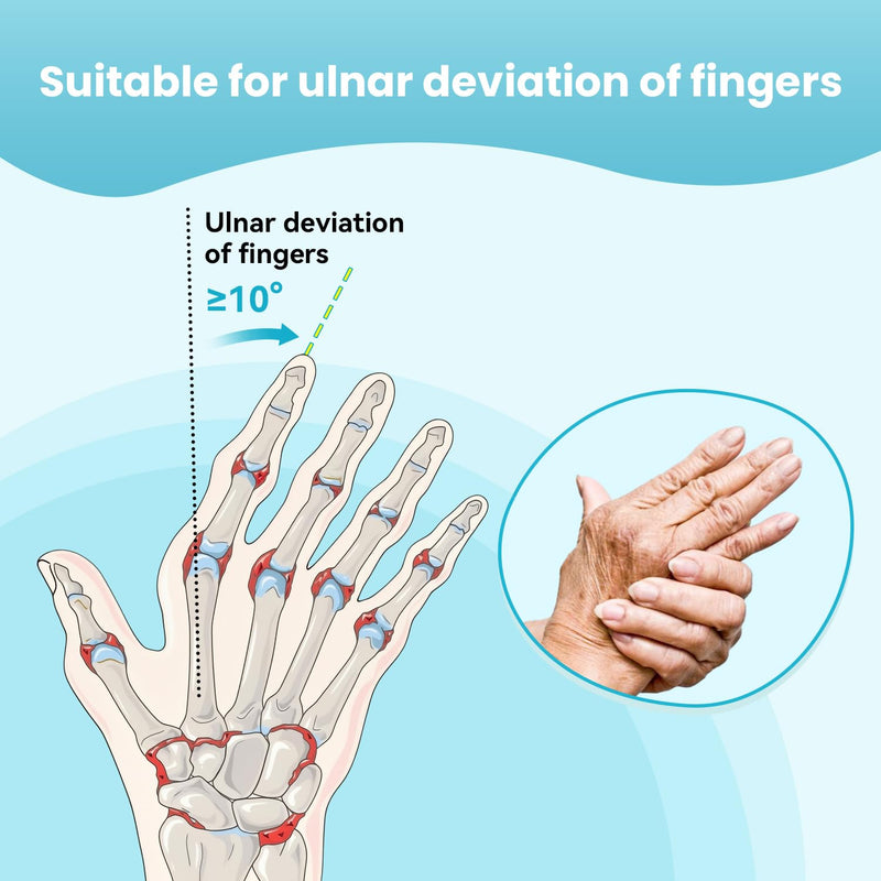 [Australia] - DrFinger Finger Ulnar Deviation Splint Brace, Finger Joint Deviation Orthopedic Corrector With Metal Bracket-Black-(Right-M) Black Right-M 