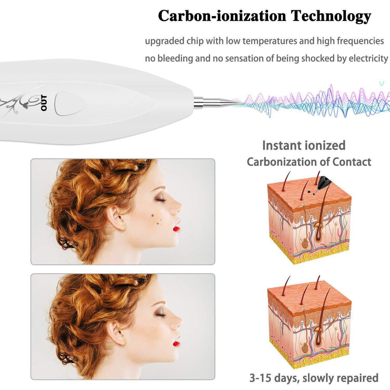 [Australia] - Mole Removal - VOONEEN Mole Removal Professional Beauty Pen, with 9 Strength Levels for Face and Body, Removal of Warts, Nevus, Birthmarks, with USB Rechargeable (White) White 