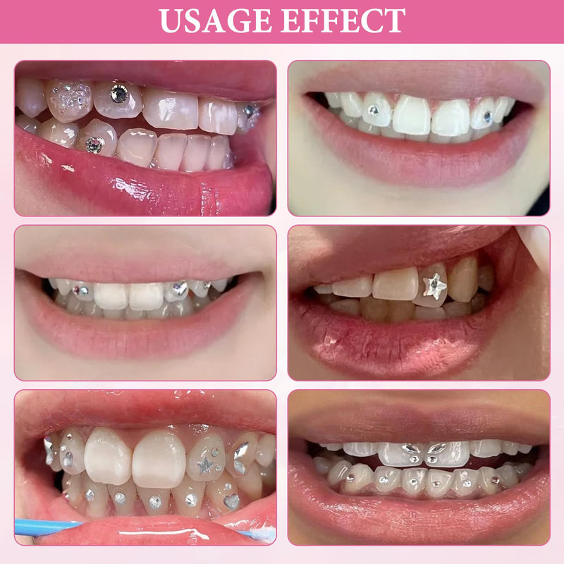 [Australia] - Tooth jewelry, tartar jewelry, tooth gem kit, tooth jewelry set, tooth stone set, DIY butterfly tooth gems with 1485 pieces tooth gem with glue, crystal jewelry starter kit 