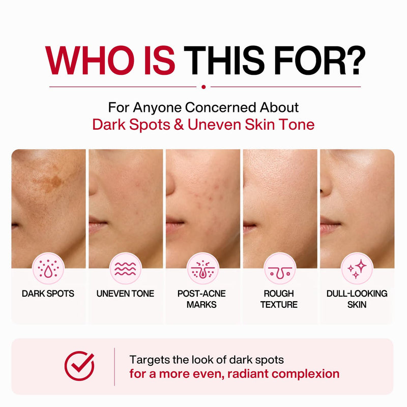 Camellia TXA CHIMTOK™ Serum, Tranexamic Acid Serum for Dark Spots, Hyperpigmentation & Melasma, TXA + Vitamin C, Korean Brightening Serum with Micro-Spicule Texture Care, 1.01 fl oz Camellia TXA Dark Spot Serum
