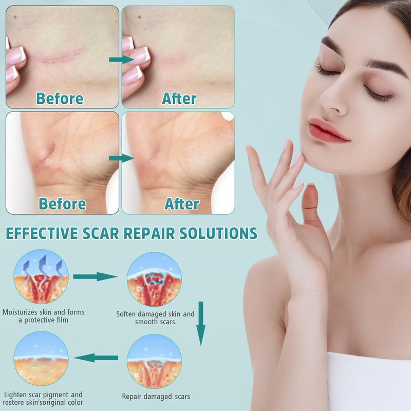 [Australia] - Advanced Scar Cream, Silicone Gel for Scars, Professional Scar Removal Cream for Surgical Scars, Stretch Marks, Old and New Scars 1.7 oz(50ml) 
