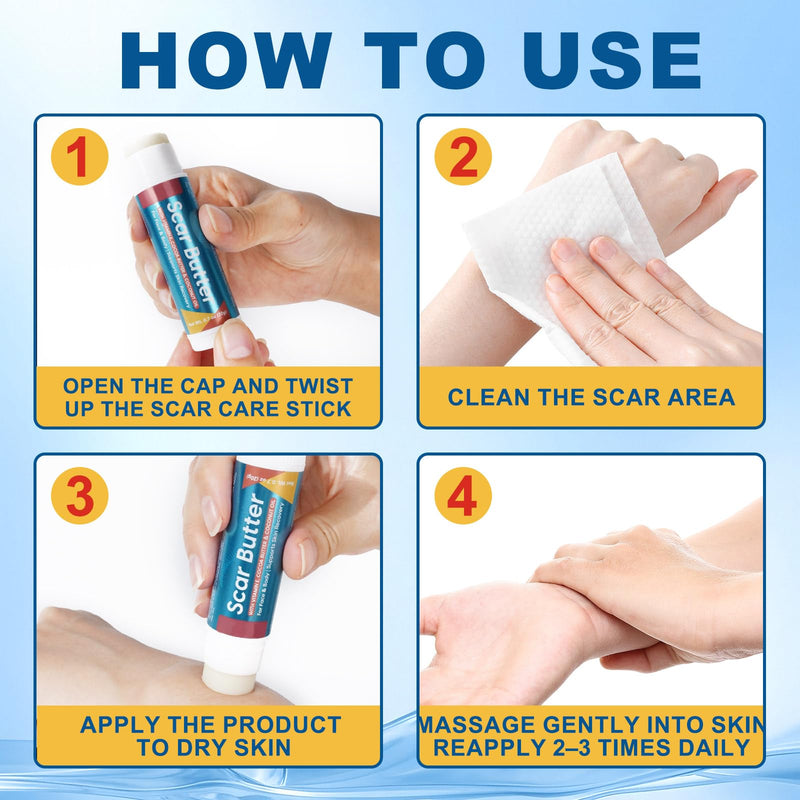 Scar Butter Stick, Scar Cream with Vitamin E & Cocoa Butter for Scars, Fade Scars, Deeply Moisturize, Light & Non-greasy, Scar Repair Stick for Old and Recent Scars and Stretch Marks | 20g