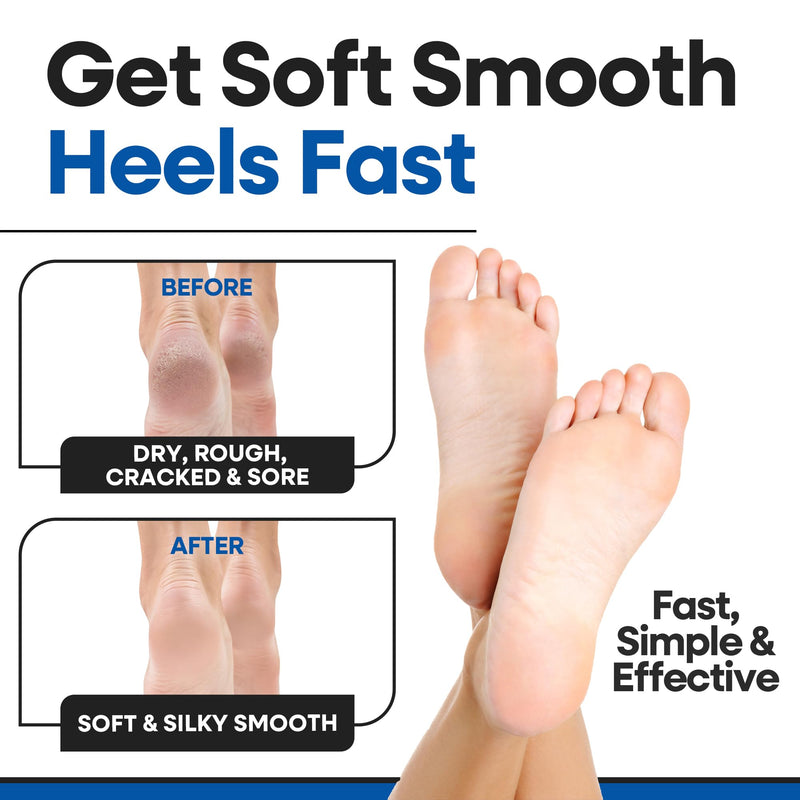 [Australia] - Moisturizing Socks for Men | Cracked Heel Treatment with Aloe Vera | Moisturizer Foot Callus Remover | Aloe Socks for Cracked Heels & Dry Cracked Feet | Lotion Infused Gel Heel Socks (Large - 3 Pairs) Black - 3 Pairs Large 