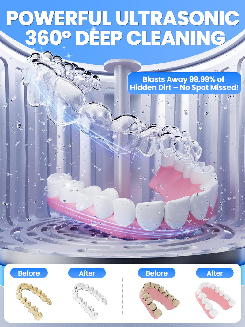 [Australia] - Dental Ultrasonic Retainer Cleaner Machine: Nicwell 200ML Denture Cleaner, Deep Cleaning Mouth Guard Cleaner, Aligner Cleaner, NightGuard Cleaner with Protection Design for Braces, Oral Dental & Tray White 
