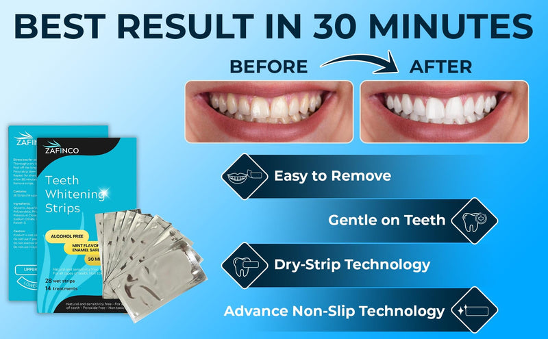 Teeth Whitening Strips for a Brighter Smile - 28 Mint Flavored Sensitive Teeth Whitening Strips, Dentist Recommended,-Non Toxic, Peroxide Free & Enamel Safe - 14 Treatments, Made in USA