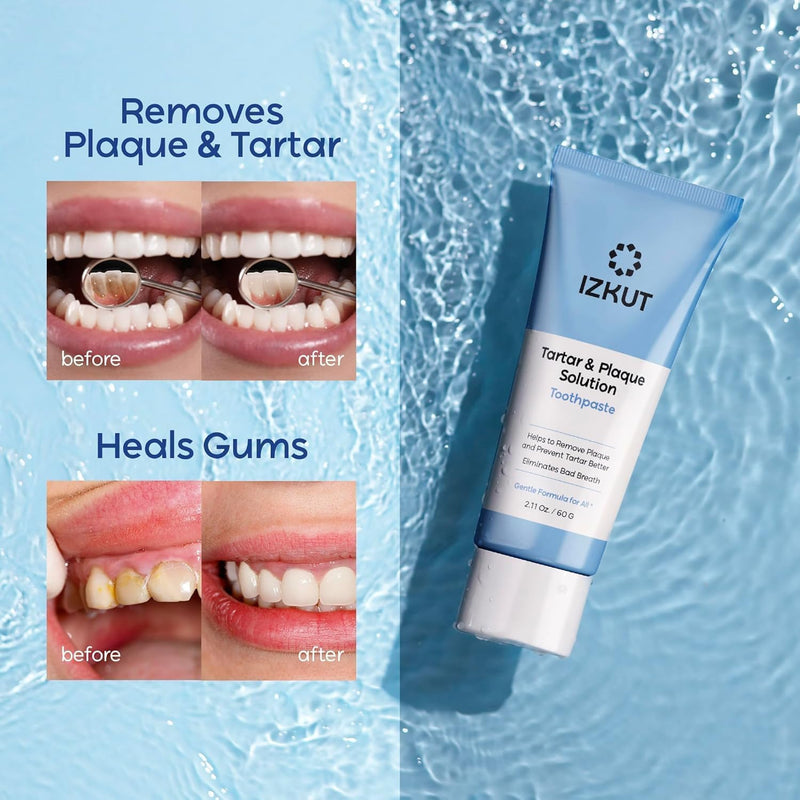 (Pack of 2) Plaque & Tartar Remover Toothpaste for Teeth: Removes Plaque & Controls Tartar Build-up – Long-Lasting Fresh Breath, Deep Cleansing, Gum-Friendly Formula, Enamel Support for Adults & Kids