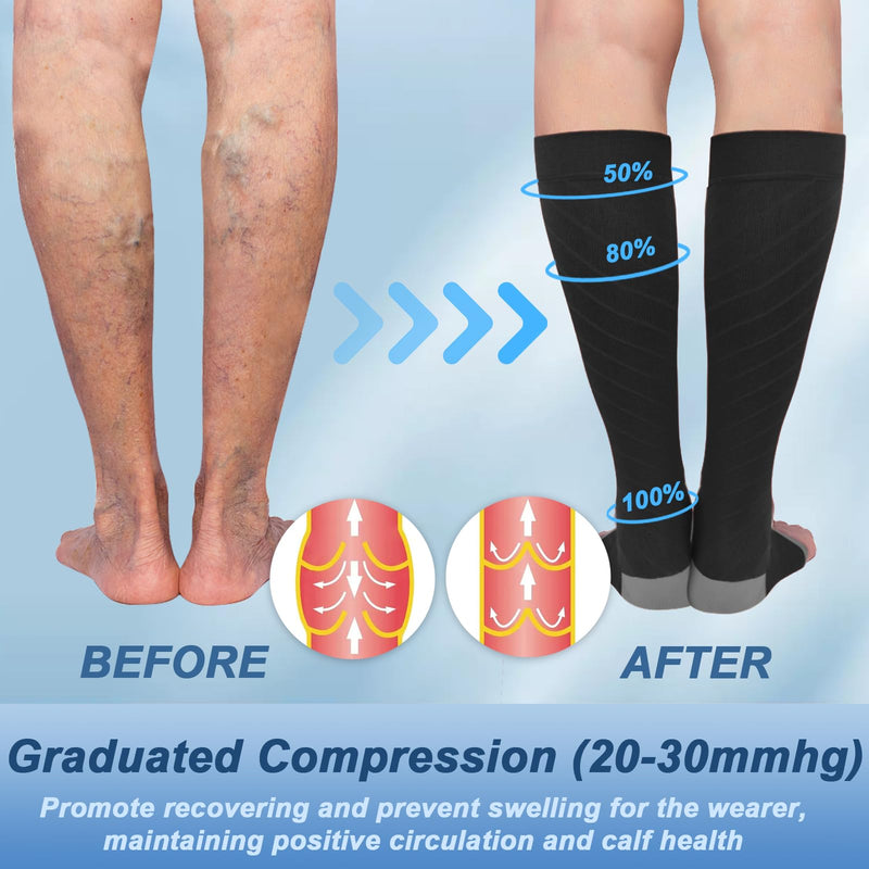 [Australia] - beister 20-30 mmHg Medical Compression Stockings for Men and Women, Open Toe Calf Compression Knee Socks, Graduated Support Stockings for Varicose Veins, Edema, Pregnancy Black Gray L 