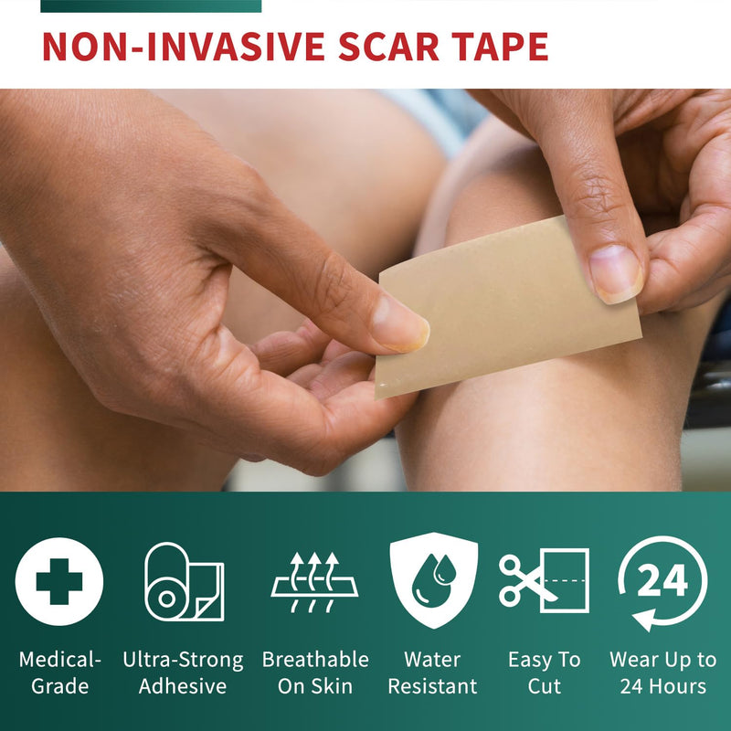 [Australia] - Medical-Grade Silicone Scar Tape Roll (1.6" x 118") Silicone Scar Sheets Keloid Bump Removal - Reusable Silicone Tape Scar Removal Strips, Scar Tape for Surgical Scars, C Section Scar Silicone Strips 1 Pack 
