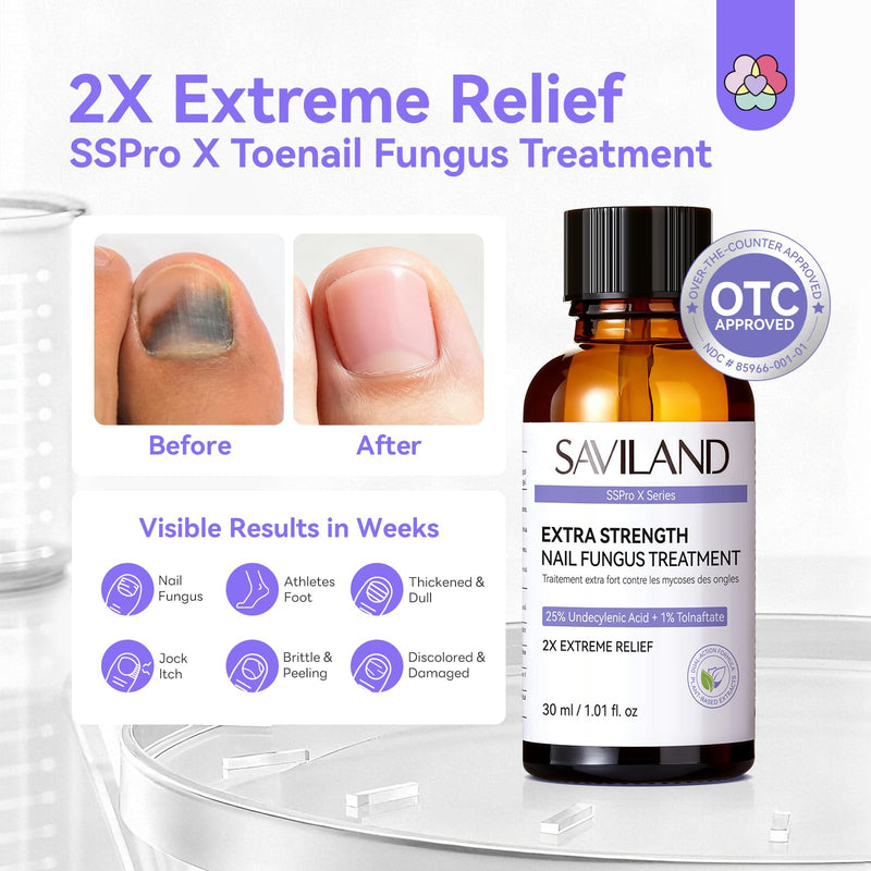 SAVILAND Toenail Fungus Treatment for Thick Discolored Damaged Nails 2oz | FSA-HSA, Max 25% Undecylenic Acid & 1% Tolnaftate, With Salicylic Acid & Vitamin E, Daily At-Home Use, Includes File & Swabs