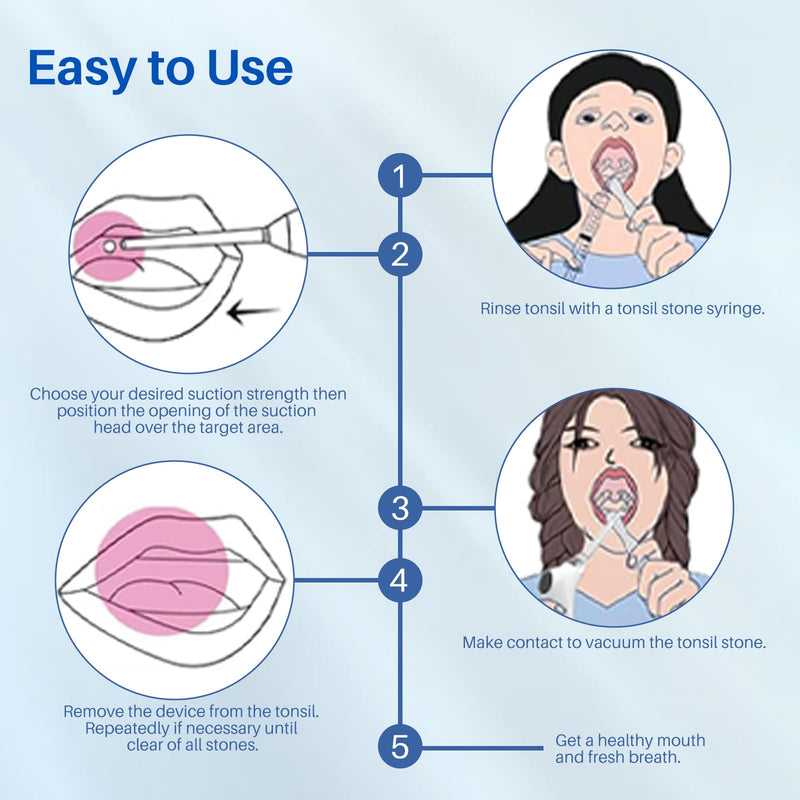 [Australia] - Upgraded Tonsil Stone Remover Tool with Silicone & Glass Probes, 11 in 1 Rechargeable Electronic Tonsil Stone Vacuum with Built-in LED Light, Fight Bad Breath Instant Suction 