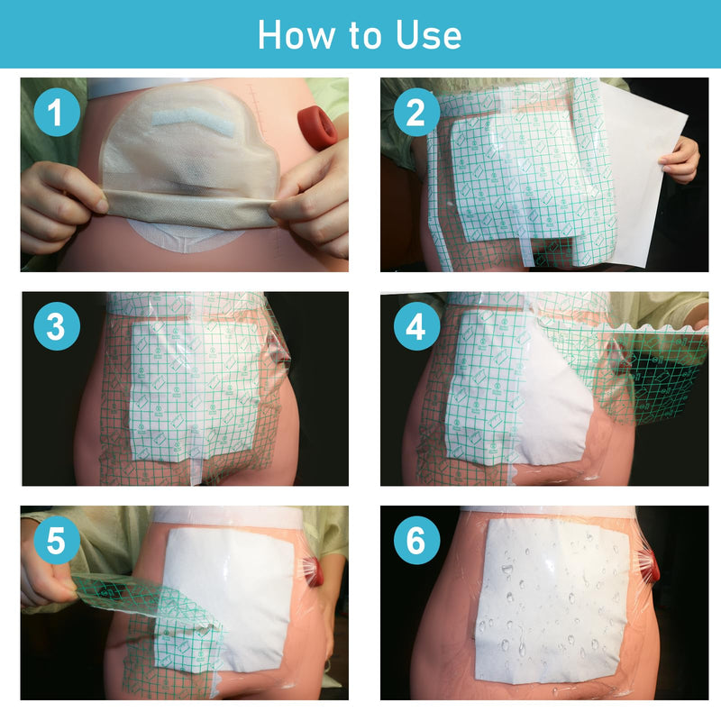 [Australia] - 25 Pcs Waterproof Ostomy Bag Shower Cover 10"x10", Stoma Bath Protector Shield Film Adhesive Dressing Bandage for Ostomy Supply Guard Accessory 