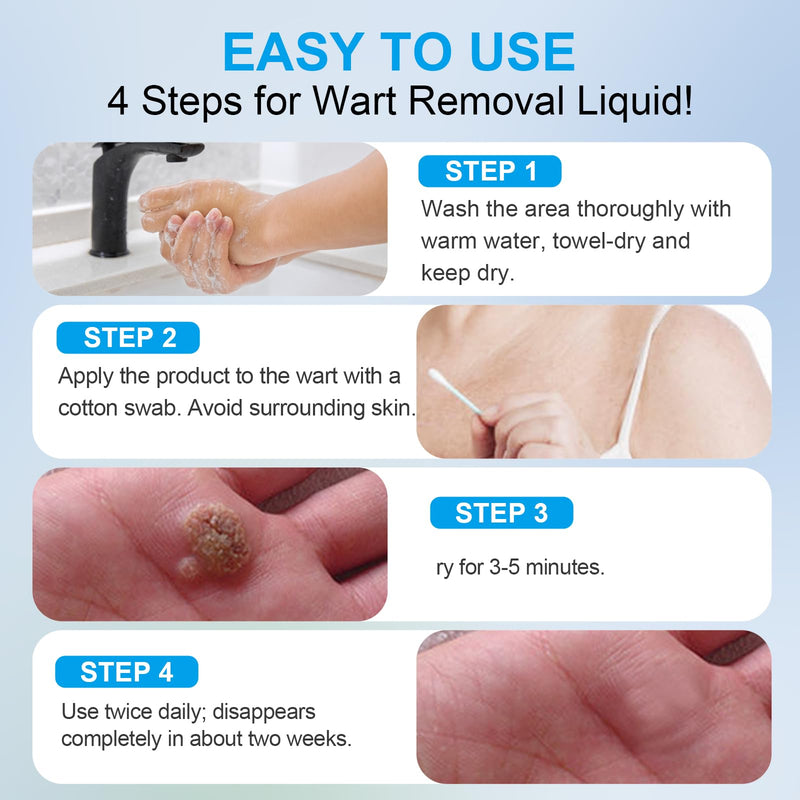 [Australia] - 2 Packs Fast-Acting Salicylic Remover: Strongest Wart Corn Removers for Feet, Body and Neck.Exclusive Formula 17% Salicylic for Plantar„ÄÅFlat„ÄÅCommon Wart, Corn. for Men and Women - 2 * 30ML 