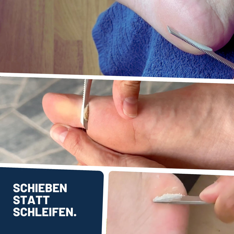 [Australia] - Mr. Fuss® No. 4 - Plus Pack Steel - Large, Cuticle Callus Remover Economy Pack 3 Pieces Active Solution Quickly Softening - 500 ml, Cotton, Stainless Steel Scraper 1 Piece (Pack of 1) 