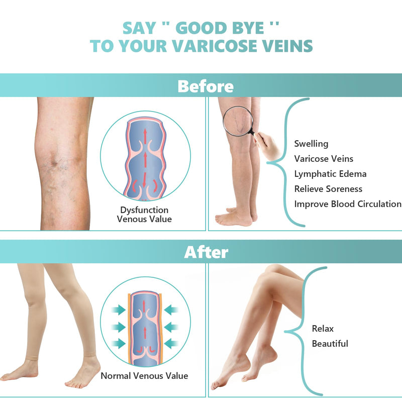 [Australia] - Compression Pantyhose for Women, 20-30 mmHg Footless Medical Compression Stockings, Waist High Opaque Graduated Support Compression Hose Tights for Edema, Varicose Veins, Swelling Beige Large 