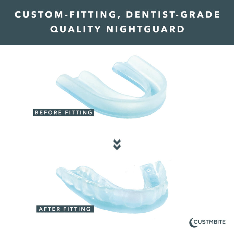 CUSTMBITE Premium Pro+ Night Guard with BiteGuard Technology, 2 Pack with Mouth Guard Case, USA Made, Mouth Guard for Grinding Teeth at Night, Bruxism NightGuard