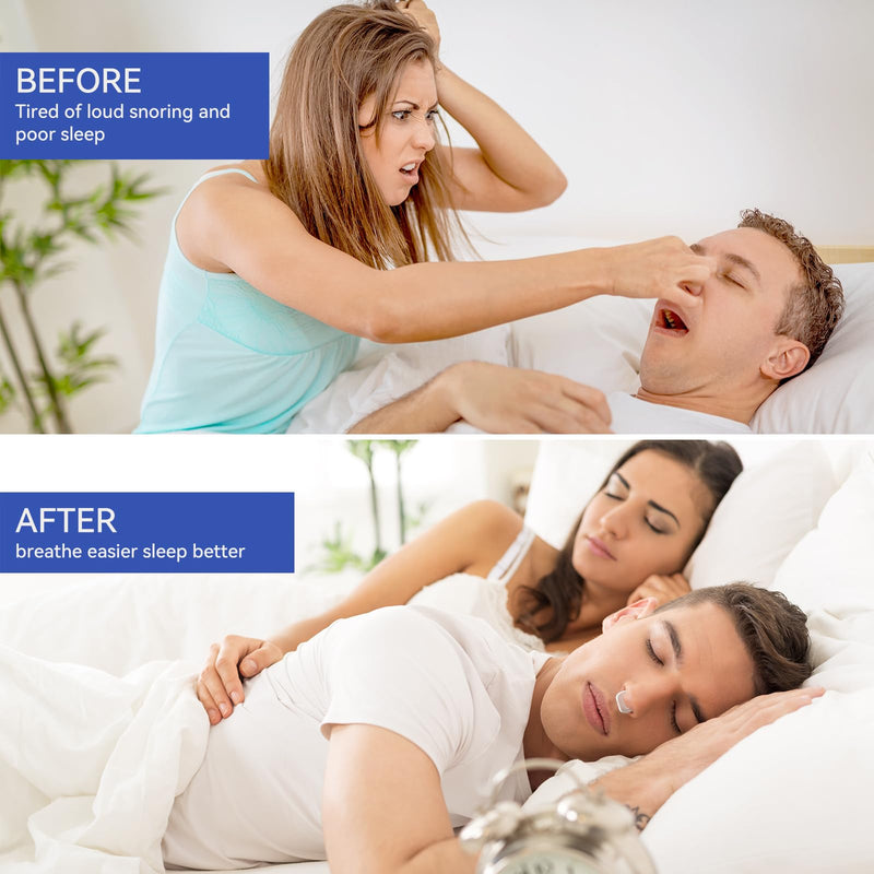 [Australia] - Anti Snoring Devices, Anngola Snoring Solution, Silicone Magnetic Anti Snoring Nose Clip, Effective Hale Breathing Aid, Stop Snoring to Restful Sleep(10 Pack) 