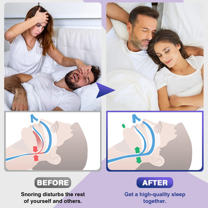 [Australia] - Anti Snoring Devices, Snore Stopper with Adjustable Magnet, Silicone Nose Clip Stop Snoring, Effective to Relieve Snoring, Snoring Solution for Comfortable and Quieter Sleep,White, M 1 White 