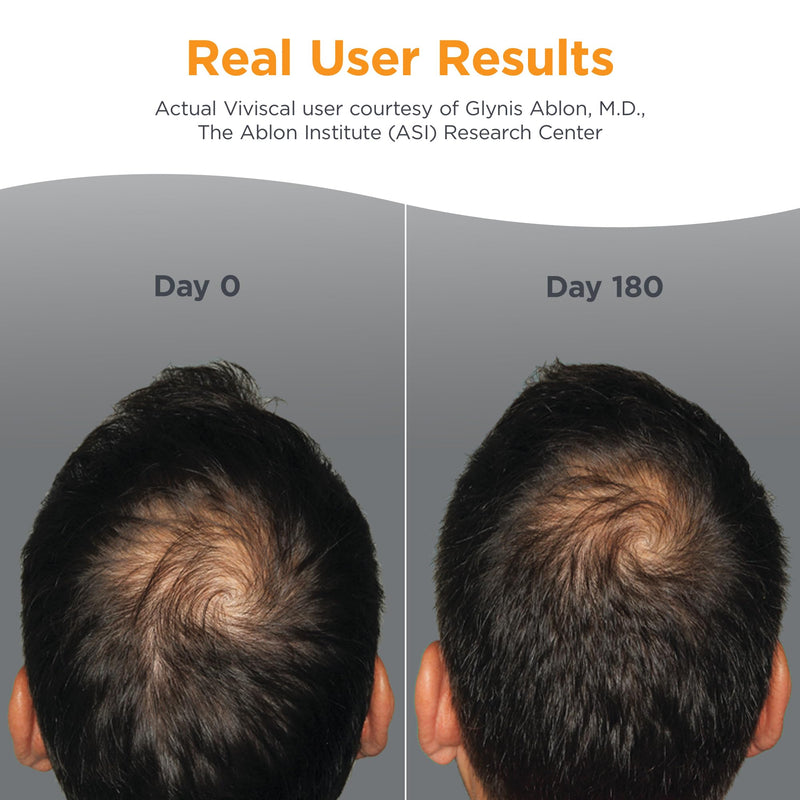 Viviscal Men's Hair Growth Supplements for Thicker Fuller Hair, Clinically Proven Collagen Complex, 60 Tablets 1 Month Supply 2.46 Ounce (Pack of 1)