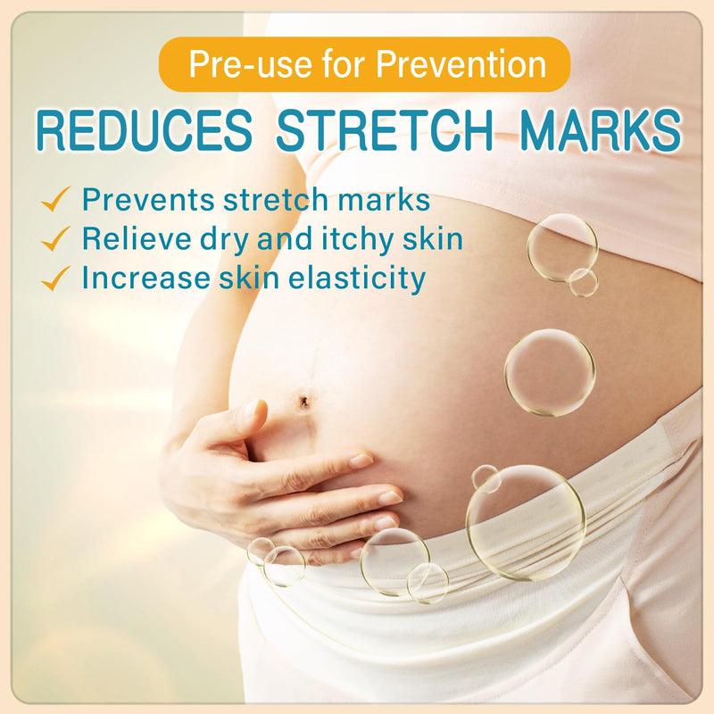 [Australia] - PEGO Stretch Mark Oil for Pregnancy, Maternity Body Oil for Stretch Mark Prevention & Reduction, Hydrating Skin Care, 5.41oz (Oil+Cream) Oil+Cream 
