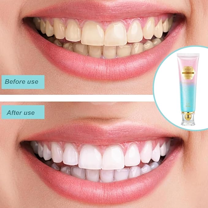 [Australia] - Niacinamide Whitening Toothpaste, Niacinamide Toothpaste, Intense Teeth whitening, Gently Repairs Sensitive Teeth, Protect Tooth Enamel, Fresh Breath, Fluoride-Free(3.5 Ounce (Pack of 2)) 