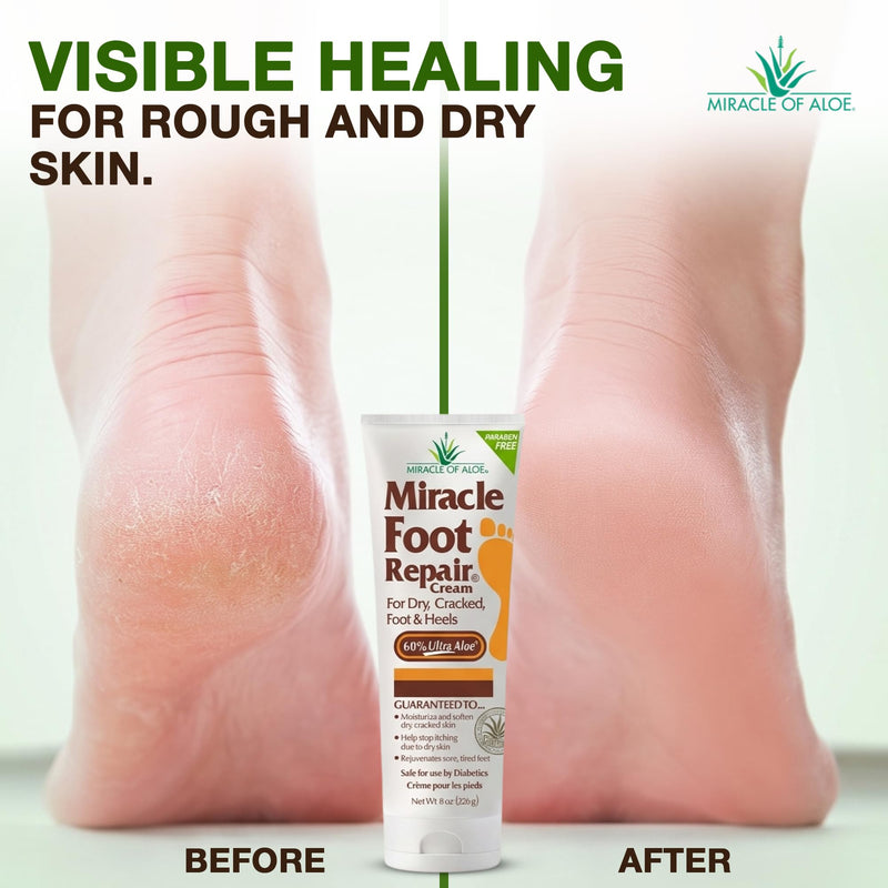 Miracle Foot Repair Cream, 8 Oz 2 Pack, For Dry Cracked Heels & Feet | 60% UltraAloe Aloe Vera Foot Moisturizer, Non Greasy Fast Absorbing Cream For Rough Dry Skin, Calluses & Night Care 8 Ounce (Pack of 2)