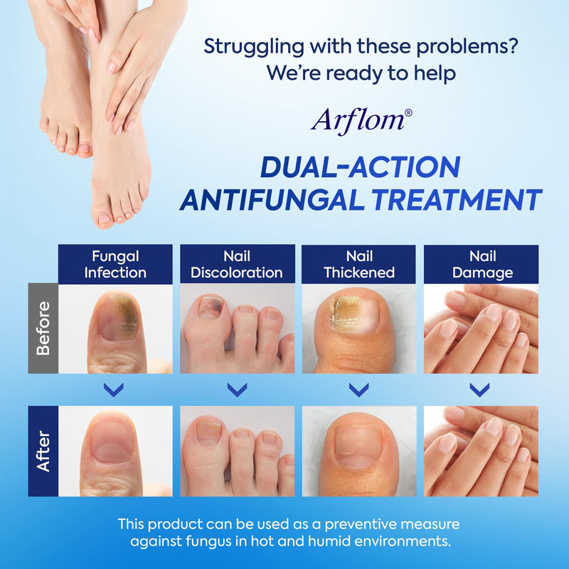 Toenail Fungus Treatment Kit: 2 Pcs Extra Strength 25% Undecylenic Acid Solution & 14 Fungal Nail Renewal Patches - for Toe Nail & Fingernail with Tea Tree Oil (0.51 Fl Oz (Pack of 2)) 0.51 Fl Oz (Pack of 2)