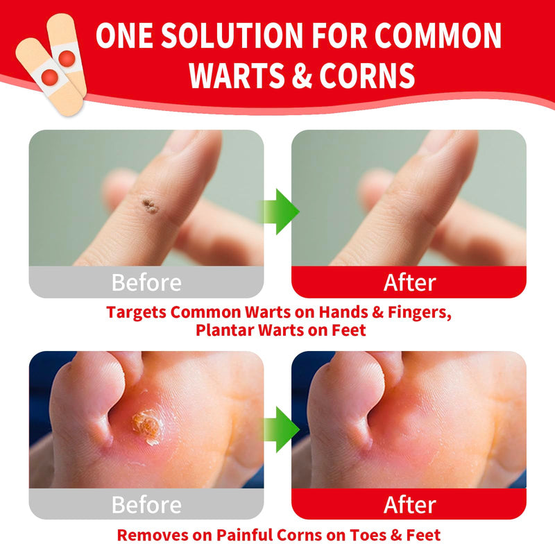 [Australia] - Wart Corn Remover Pads for Toes Feet, 42 Count 40% Salicylic Acid Extra Strength Bandages, Corn Callus Wart Remover Cushions Patches for Plantar Foot, Safe Effective Treatment Removal for Men Women 
