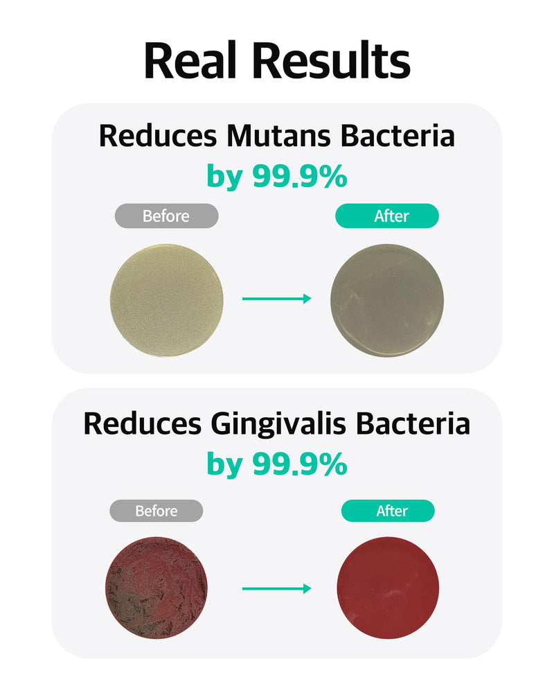 Live Orals PureBreath Toothpaste 80g (Pack of 3) - Fluoride-Free, Odor Neutralizing, Enamel Strengthening, Gentle Cleaning, Mint Fresh, Naturally Derived Ingredients, Sensitive Teeth Friendly Pack of 3