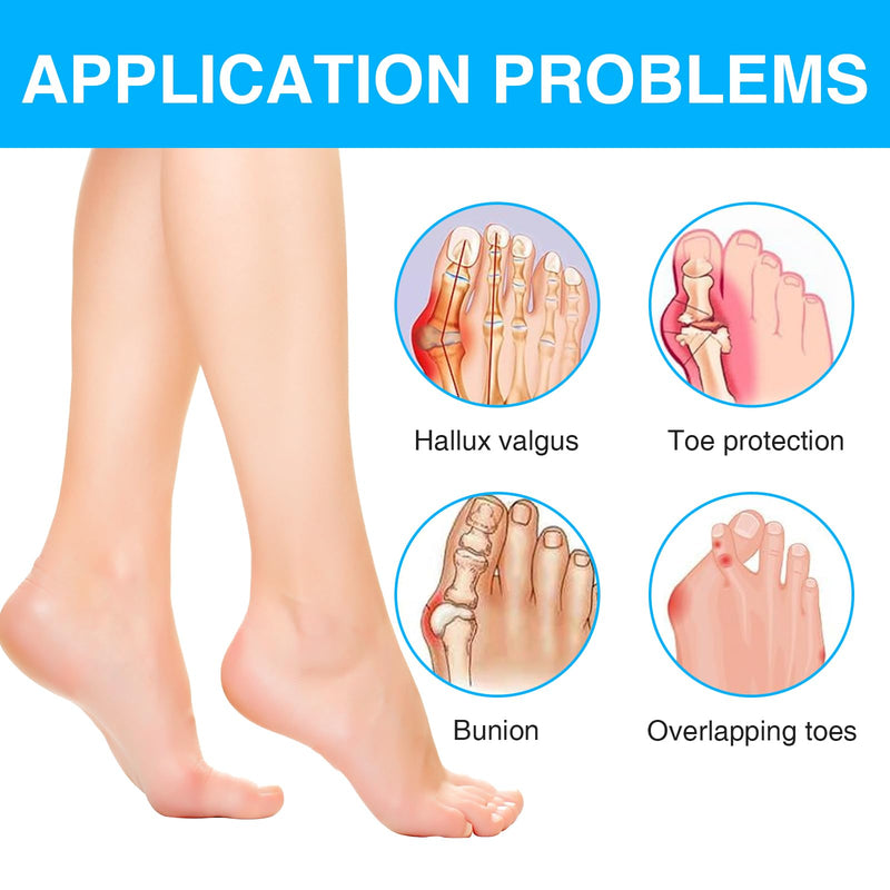 [Australia] - Katyjun 2x Hallux Valgus correction splint with 2x toe separators, bunion corrector 