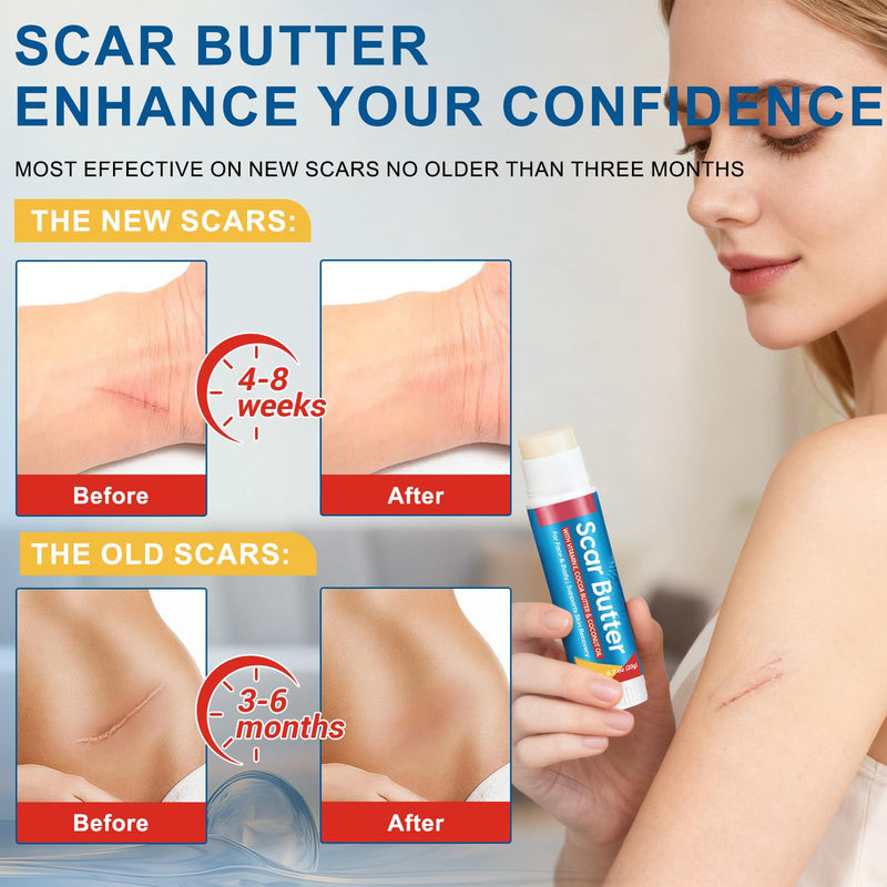 Scar Butter Stick, Scar Cream with Vitamin E & Cocoa Butter for Scars, Fade Scars, Deeply Moisturize, Light & Non-greasy, Scar Repair Stick for Old and Recent Scars and Stretch Marks | 20g