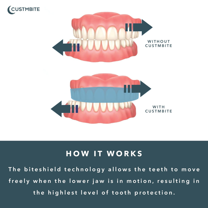 CUSTMBITE Premium Pro+ Night Guard with BiteGuard Technology, 2 Pack with Mouth Guard Case, USA Made, Mouth Guard for Grinding Teeth at Night, Bruxism NightGuard