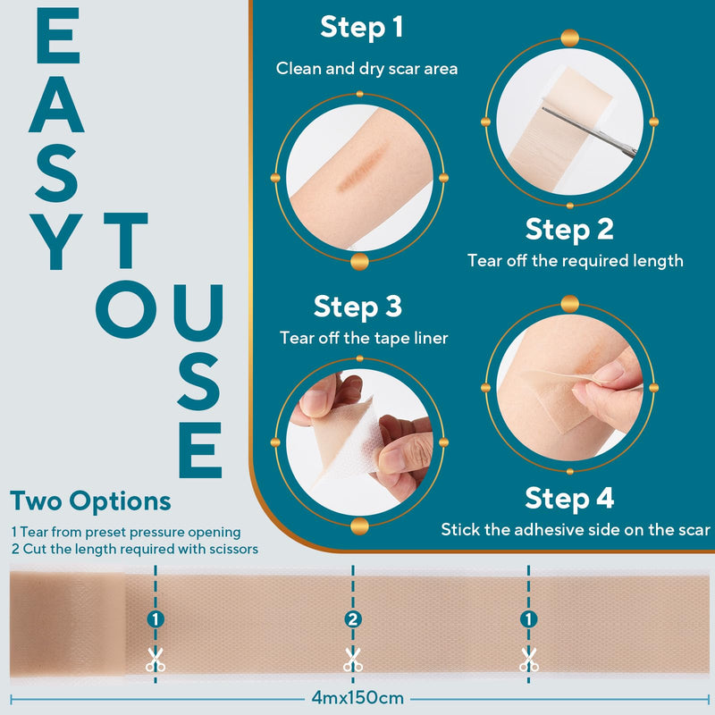 [Australia] - Silicone Scar Sheets, Silicone Scar Tape, Reusable Scar Silicone Strips for Scar Removal Treatment, Soft Silicone Scar Sheets for Surgical Scars, Keloid, C-Section, Burn et(1.6‚Äù x 59‚Äù Roll-1.5M) 1.5M 