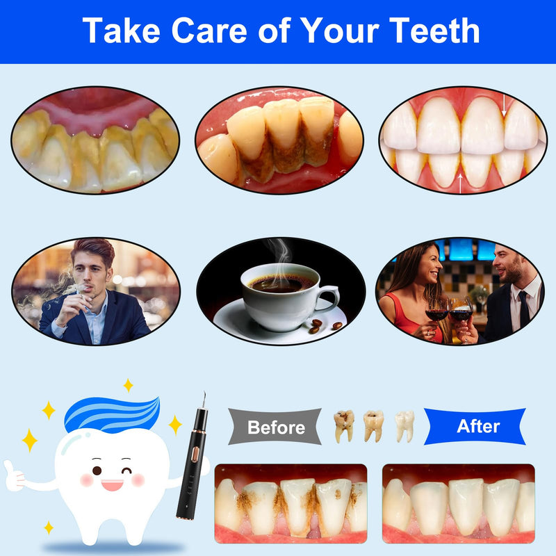 [Australia] - Plaque Remover for Teeth, Tartar Remover for Teeth Cleaning with 4 Replaceable Heads and 3 Adjustable Modes, Rechargeable Teeth Cleaning Plaque Remover for Home 