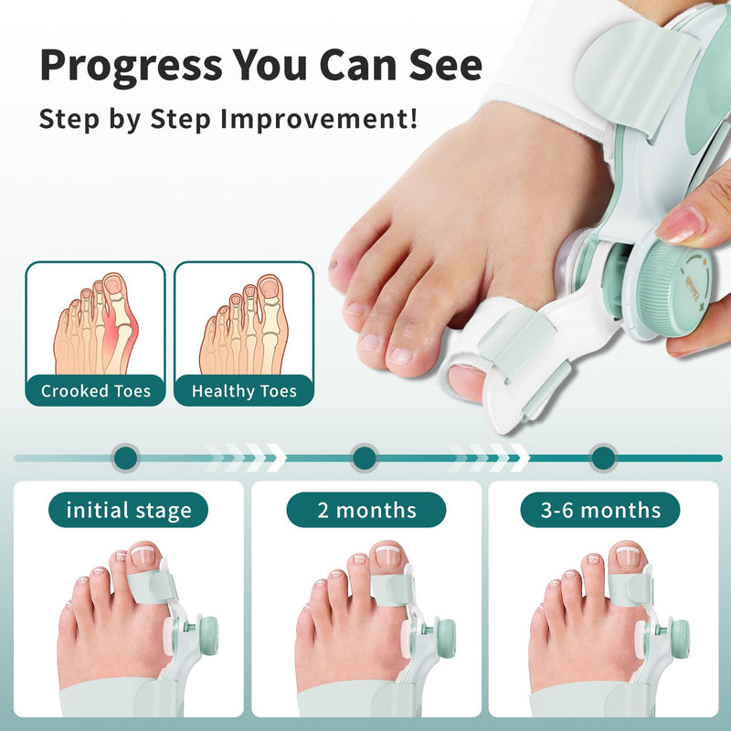 [Australia] - 2 PCS Bunion Corrector for Women Big Toe, Adjustable Brace with Knob & Angled Plates for Hallux Valgus Relief & Toe Alignment, Medium Strap Green 2 