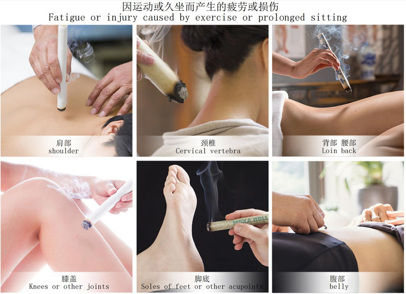 [Australia] - Moxa Stick Used for Moxibustion,The Moxibustion Sticks are Made of Pure Natural Mugwort as raw Material,extracted at a Ratio of 20:1.Moxa Sticks for moxibustion,ËâæÊù° ËâæÁÅ∏Ê£íPure moxi Rolls 10rolls 