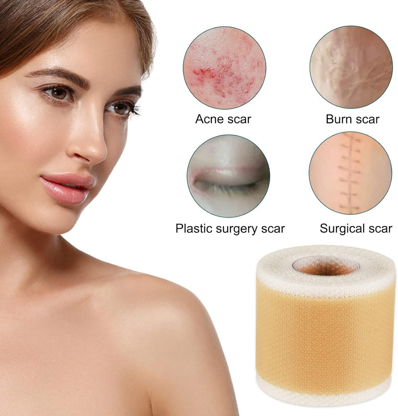 [Australia] - Silicone Scar Tape Silicone Plaster for Scars Scar Plaster Silicone Silicone Plaster for Scars (4 x 300 cm) Ultra Thin Soft and Breathable Suitable for Burns and Cesarean Section Scars 