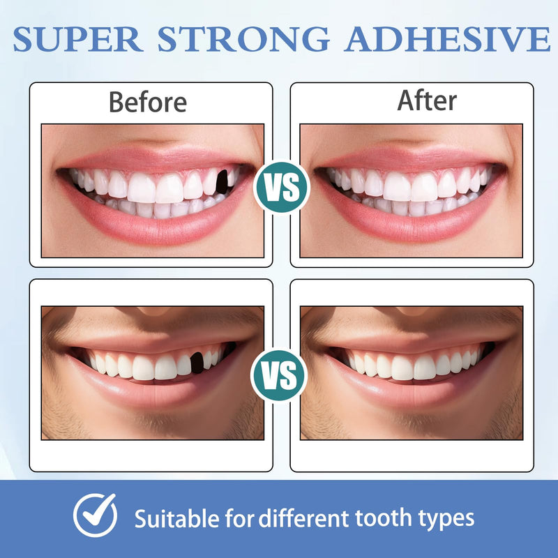 [Australia] - Tooth Repair Kit 6PCS, Temporary Natural Shade for Filling Broken or Missing Tooth, Moldable Thermal Beads Replacement Kit for Easy Teeth Repairs 
