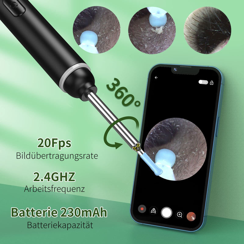 [Australia] - Earwax Remover Otoscope, VITCOCO 1920P Wifi Ear Cleaner, Ear Cleaner with Camera, Otoscope with 6 LEDs for iPhone, iPad and Android Smartphones, Black 