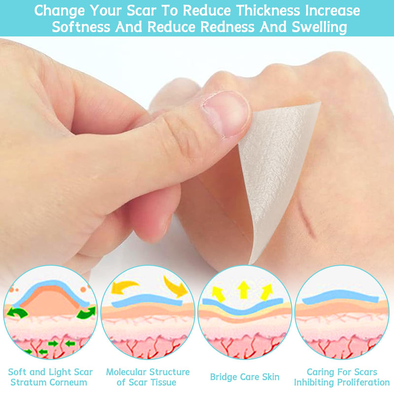 [Australia] - Volhuluk Transparent Silicone Scar Plaster (4x150cm), Silicone Plaster Professional for C-Section Scars, Operations, Burns, Keloid, Acne and More, Silicone Plaster for Scars 