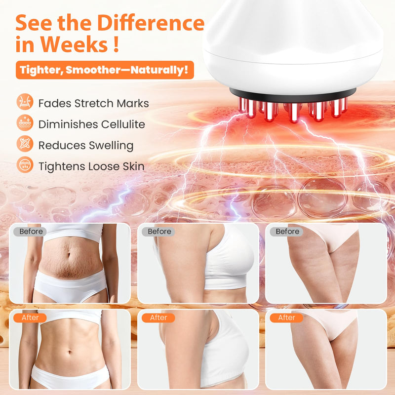 GDQ Lymphatic Drainage Massager, 9-Level Cellulite Massage Tool 21 Massage Nodes, Red Light, Heat & Vibration, Advanced Level Control, for Belly, Arms, Thighs & Full-Body Care