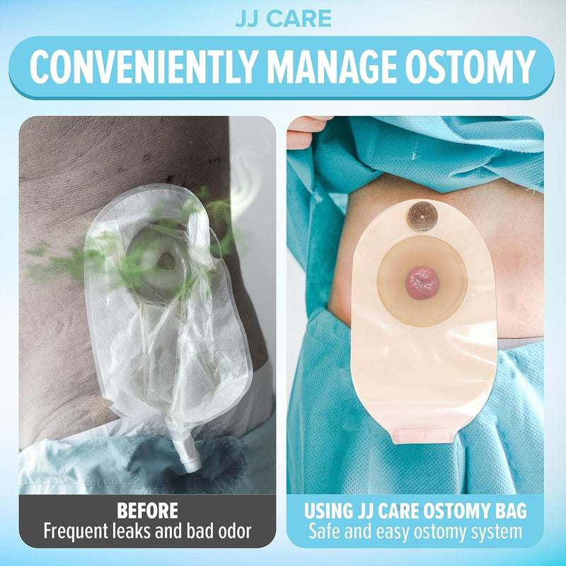 [Australia] - JJ CARE Colostomy Bags 20 PCS, One-Piece Pouching Ostomy Bags, No Mess Ostomy Supplies for Ileostomy, Colostomy, Urostomy Stoma Care with Odor Barrier, Drainable Ostomy Pouch with Cut to Fit Closure 