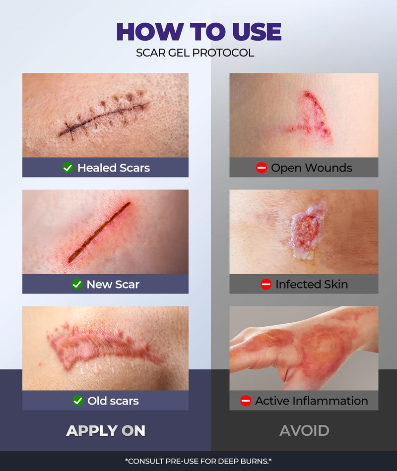 [Australia] - Silicone Scar Cream with 6.7% Active Ingredients, Scar Gel Visible in 2 Weeks, Moisturizing Scar Removal Clinically Show for Surgical, C-Section, Keloid, Acne & Burn Scars, Stretch Mark Cream(55ML) 