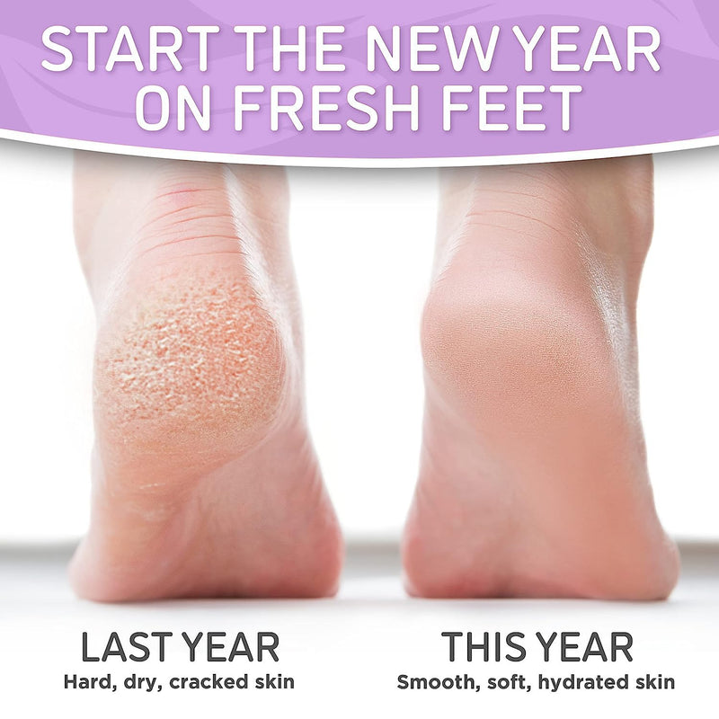 Dermora Soft Touch Foot Peel Mask - Pack of 2 Feet Peeling Masks for Dry, Cracked Heels & Calluses - Exfoliating Foot Mask Peel for Baby Soft Skin, Lavender | Botanical Extracts, Fits Most Sizes Up to Men's 11, 60-Minute Wear Time, Helps Remove Dry, Ro...