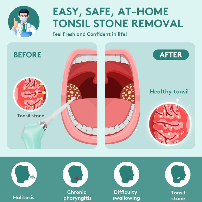 [Australia] - Electronic Vacuum Tonsil Stone Remover - Tonsil Stone Removal Kit with Built-in LED Light & 3 Suction Mode - Fight Bad Breath Oral Irrigator & 5X Magnifying Mirror for Tonsil Stone Removal - Green 